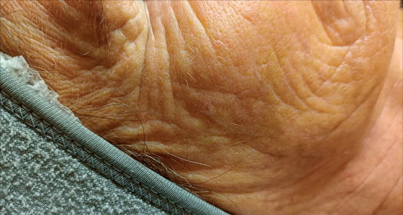 Trattamenti viso anti-age
