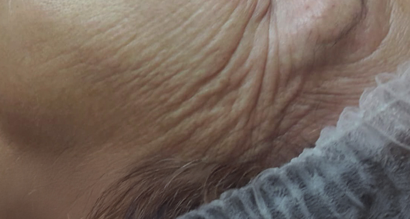 Trattamenti viso anti-age