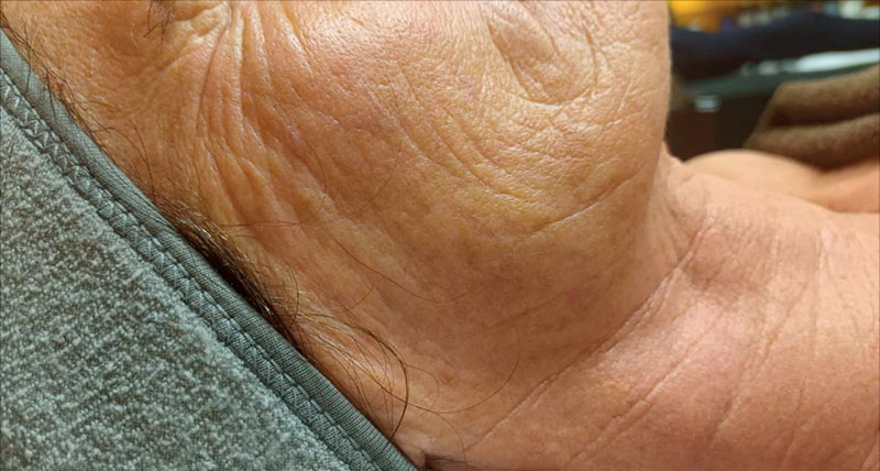 Trattamenti viso anti-age