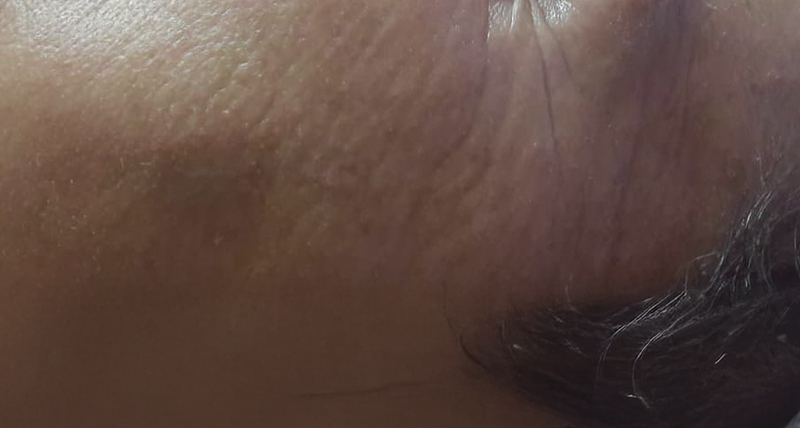 Trattamenti viso anti-age